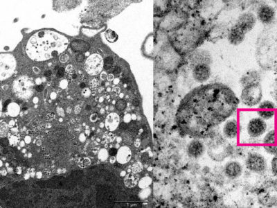 Ômicron é identificada em 31,7% dos testes de Covid-19 do país